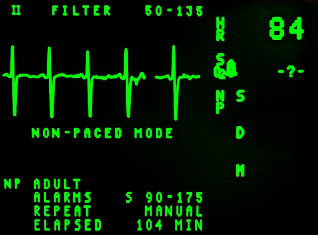 electrocardiogram-16948_640
